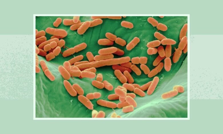 سحب براعم الفجل Robust Radish Mix (5 أونصات) بسبب احتمال E. coli والسالمونيلا