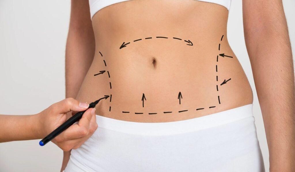 عملية شفط الدهون من منظور جراح التجميل اللبناني علي عبد علي