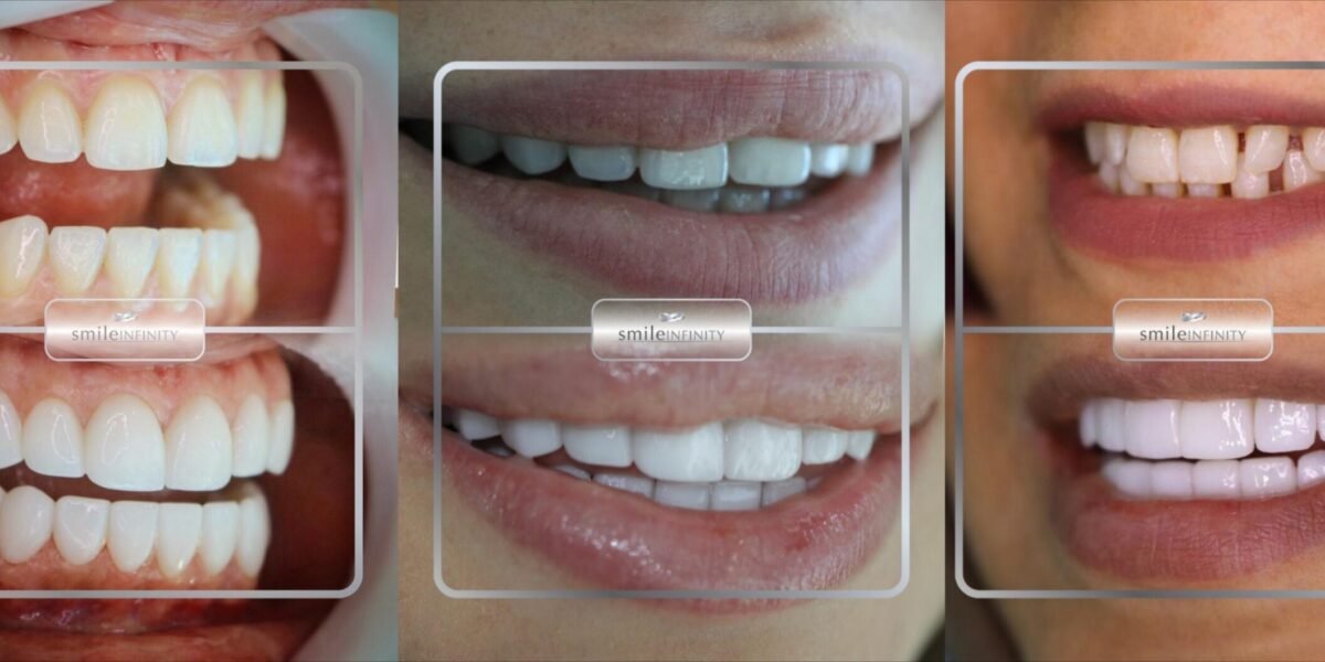 عيادة الدكتور حبيب ظريفه “Ferrari Dental Clinic by Smile Infinity” سبيلك الفريد للحصول على ابتسامة ساحرة