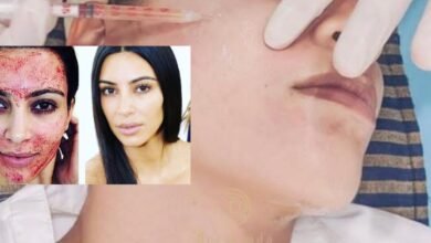 Dermand Clinic تقدم تقنية الـ”PRP” بجودة عالية واهتمامٍ لا مثيل له