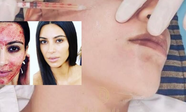 Dermand Clinic تقدم تقنية الـ”PRP” بجودة عالية واهتمامٍ لا مثيل له