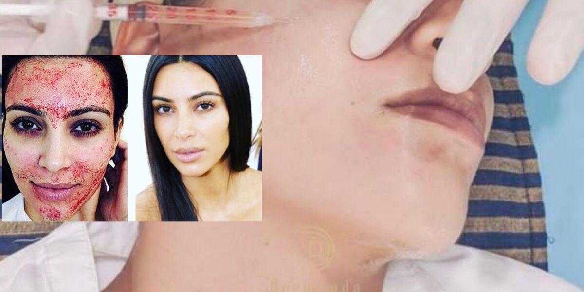 صورة مميزة: Dermand Clinic تقدم تقنية الـ”PRP” بجودة عالية واهتمامٍ لا مثيل له
