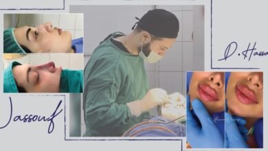 الدكتور حسام الوسوف والتقنية العالية في الجراحة التجميلية
