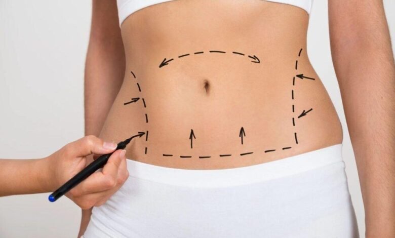 عملية شفط الدهون من منظور جراح التجميل اللبناني علي عبد علي