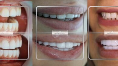 عيادة الدكتور حبيب ظريفه “Ferrari Dental Clinic by Smile Infinity” سبيلك الفريد للحصول على ابتسامة ساحرة