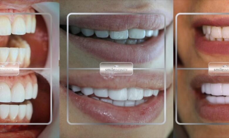 عيادة الدكتور حبيب ظريفه “Ferrari Dental Clinic by Smile Infinity” سبيلك الفريد للحصول على ابتسامة ساحرة